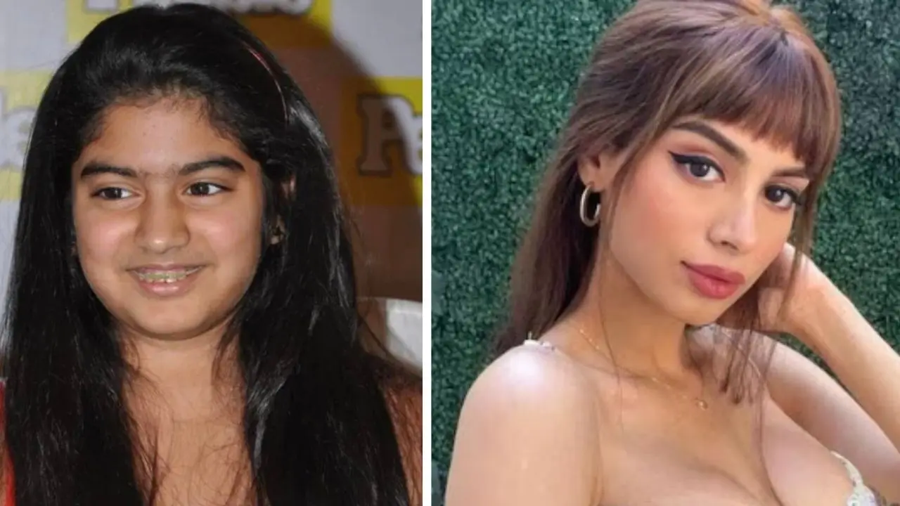 Khushi Kapoor admits getting cosmetic surgeries, says 'No big deal' Khushi Kapoor admits getting cosmetic surgeries, says 'No big deal'