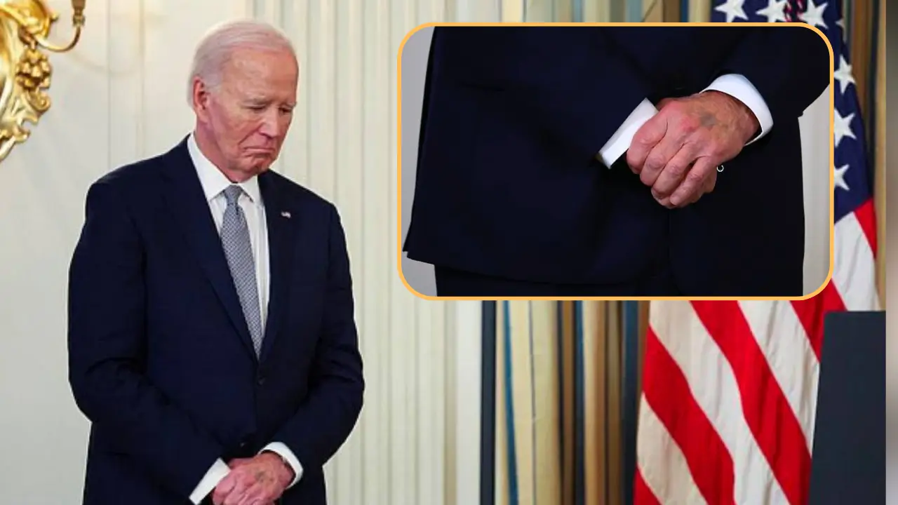 Watch: Joe Biden's mysterious purple bruise sparks speculation online Watch: Joe Biden's mysterious purple bruise sparks speculation online