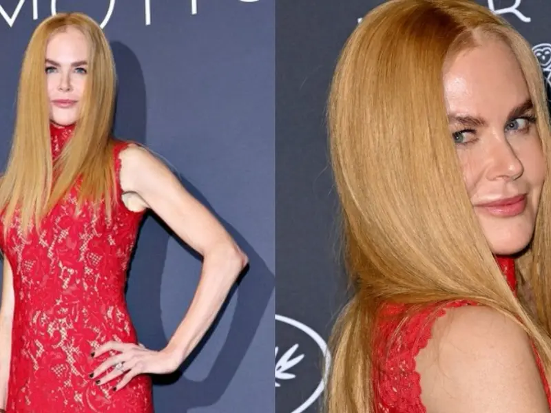Oops Moment! Nicole Kidman's major fashion mishap on Cannes red carpet Oops Moment! Nicole Kidman's major fashion mishap on Cannes red carpet