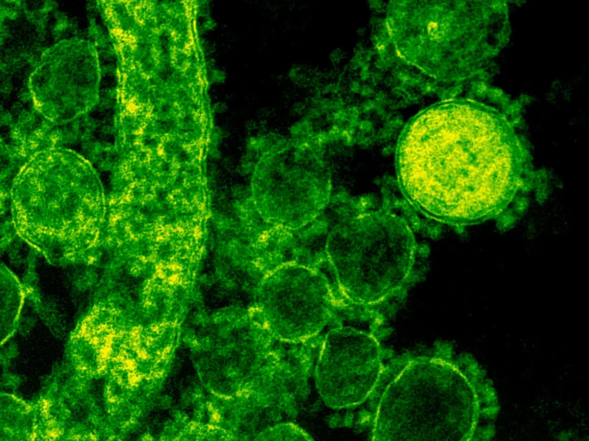What are biological pathogens?