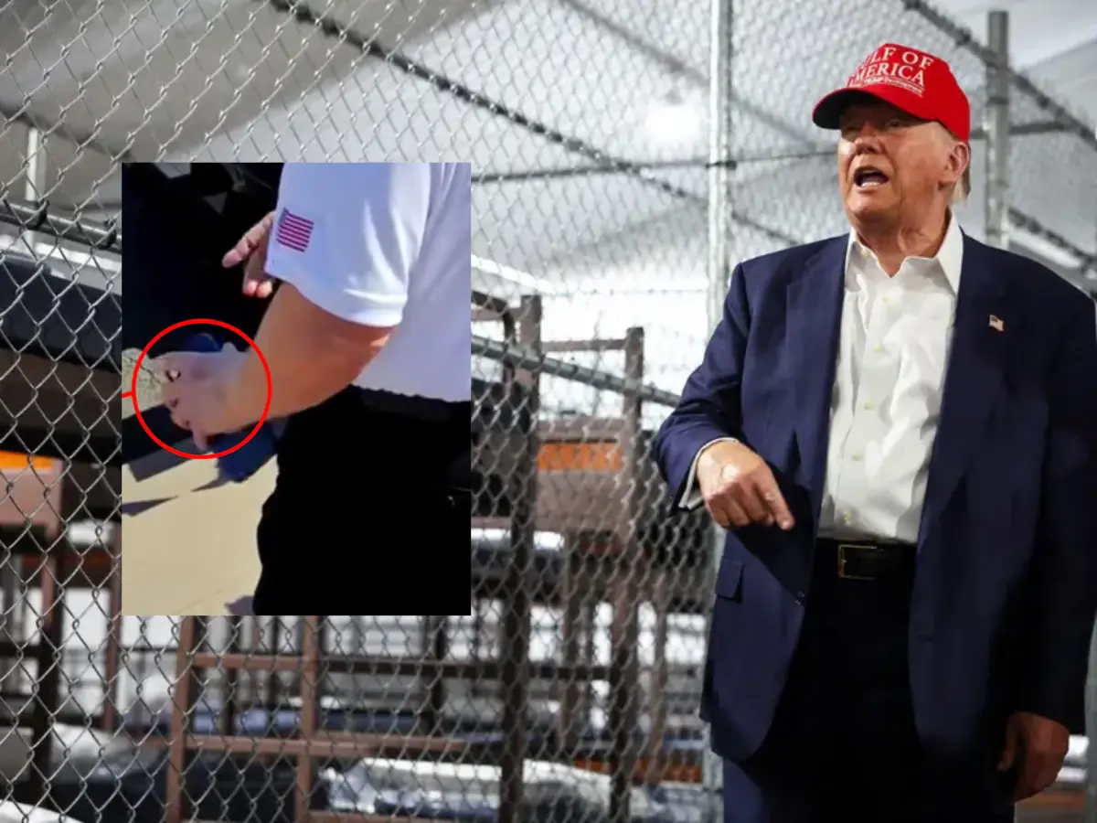 White House repeats bizarre 'shakes hands with people' theory over Trump's left-hand bruise - What his doctor said White House repeats bizarre 'shakes hands with people' theory over Trump's left-hand bruise - What his doctor said