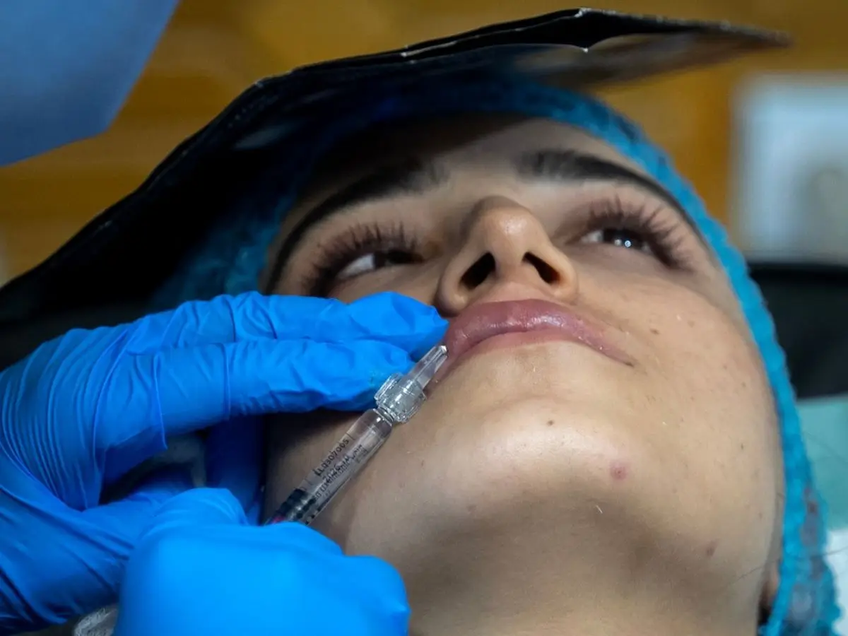 Botox under burqas, unlikely boom of cosmetic surgery in Taliban conservatism