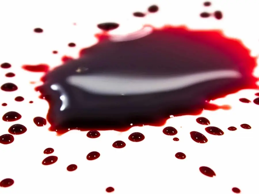 Scientists discover world's rarest blood group found only in 3 people