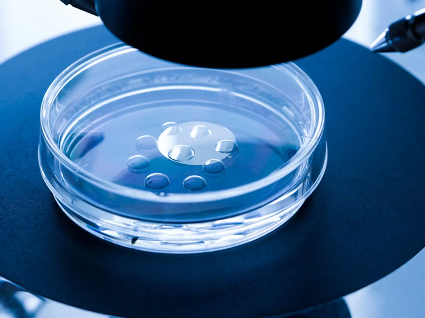 Sperm donor scandal: Cancer-risk gene passed by donor to 200 children in Europe Sperm donor scandal: Cancer-risk gene passed by donor to 200 children in Europe