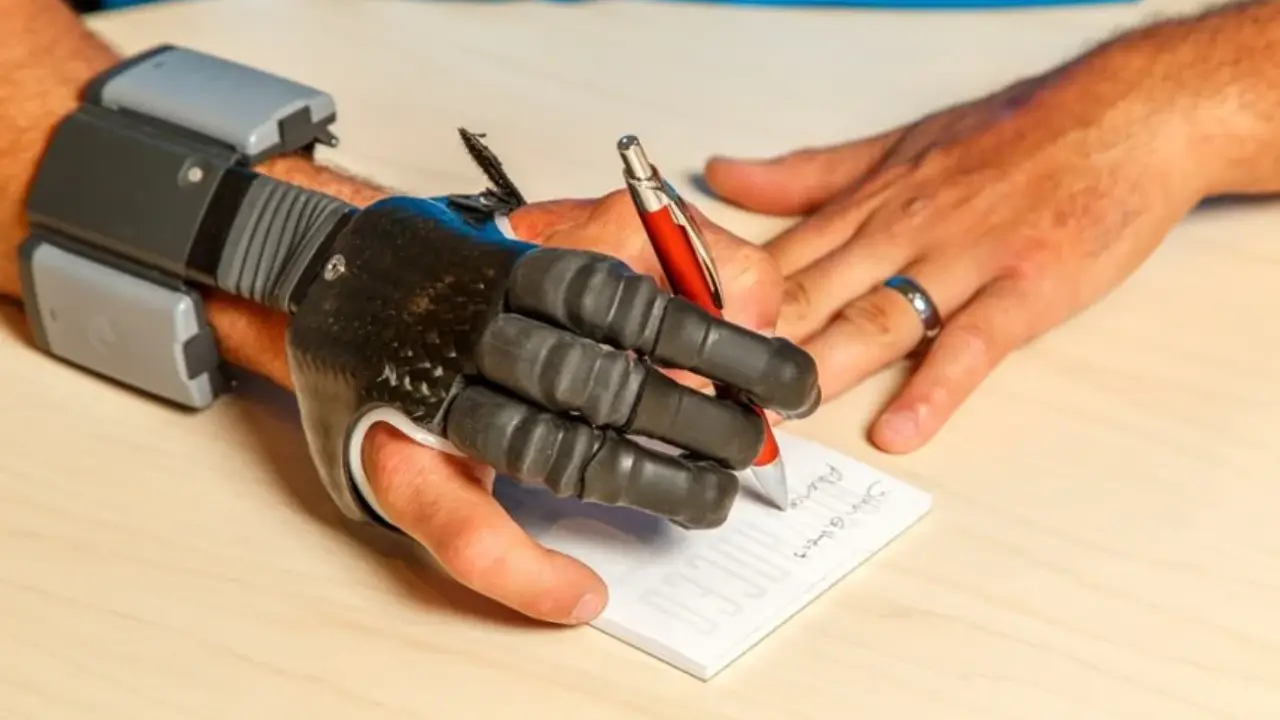 Why advanced bionic hands fail, and how AI is fixing the problem