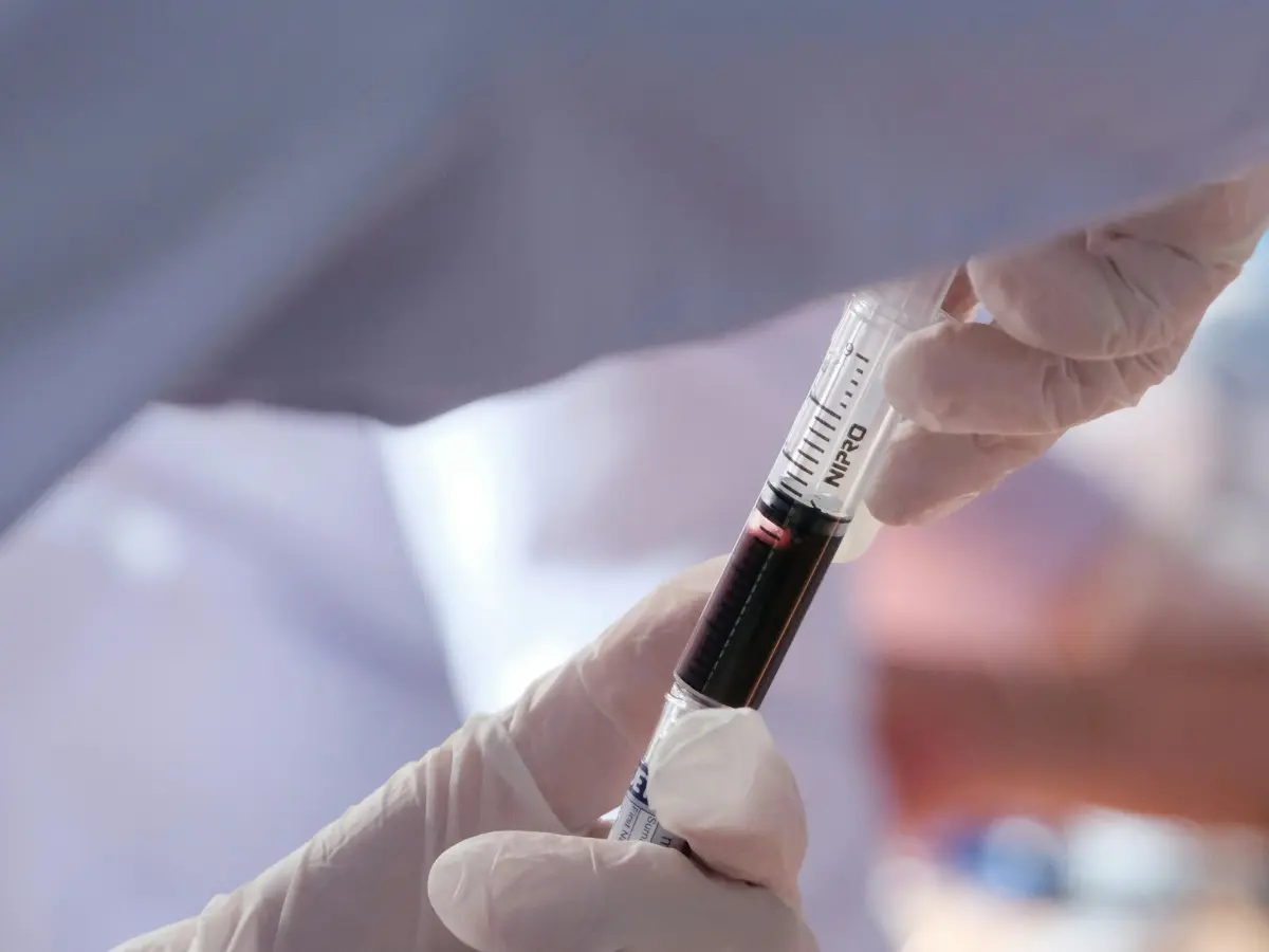 Doctors stunned to see 'male blood' in Brazilian woman who suffered miscarriage