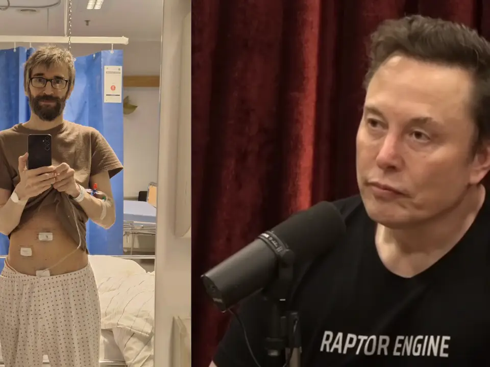 Grok AI helped detect appendicitis? Elon Musk says Grok can read X-rays and MRIs more accurately Grok AI helped detect appendicitis? Elon Musk says Grok can read X-rays and MRIs more accurately