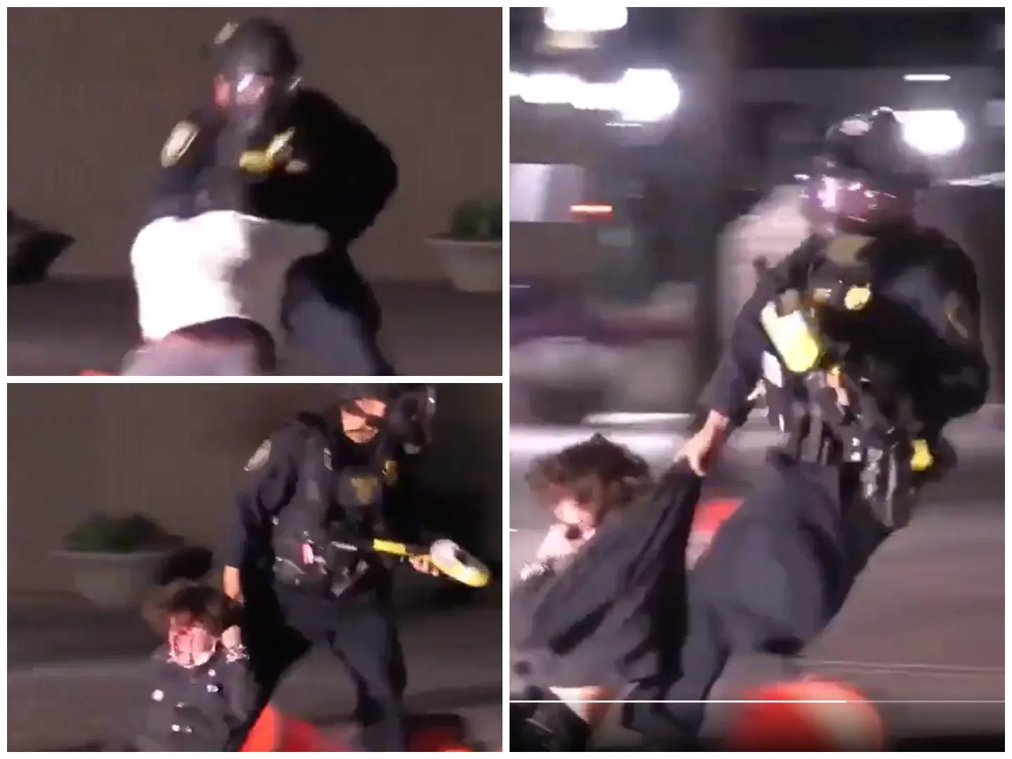 Anti-ICE protestor shot at, dragged, left blind after 6-hour surgery in altercation caught on video | Watch Anti-ICE protestor shot at, dragged, left blind after 6-hour surgery in altercation caught on video | Watch