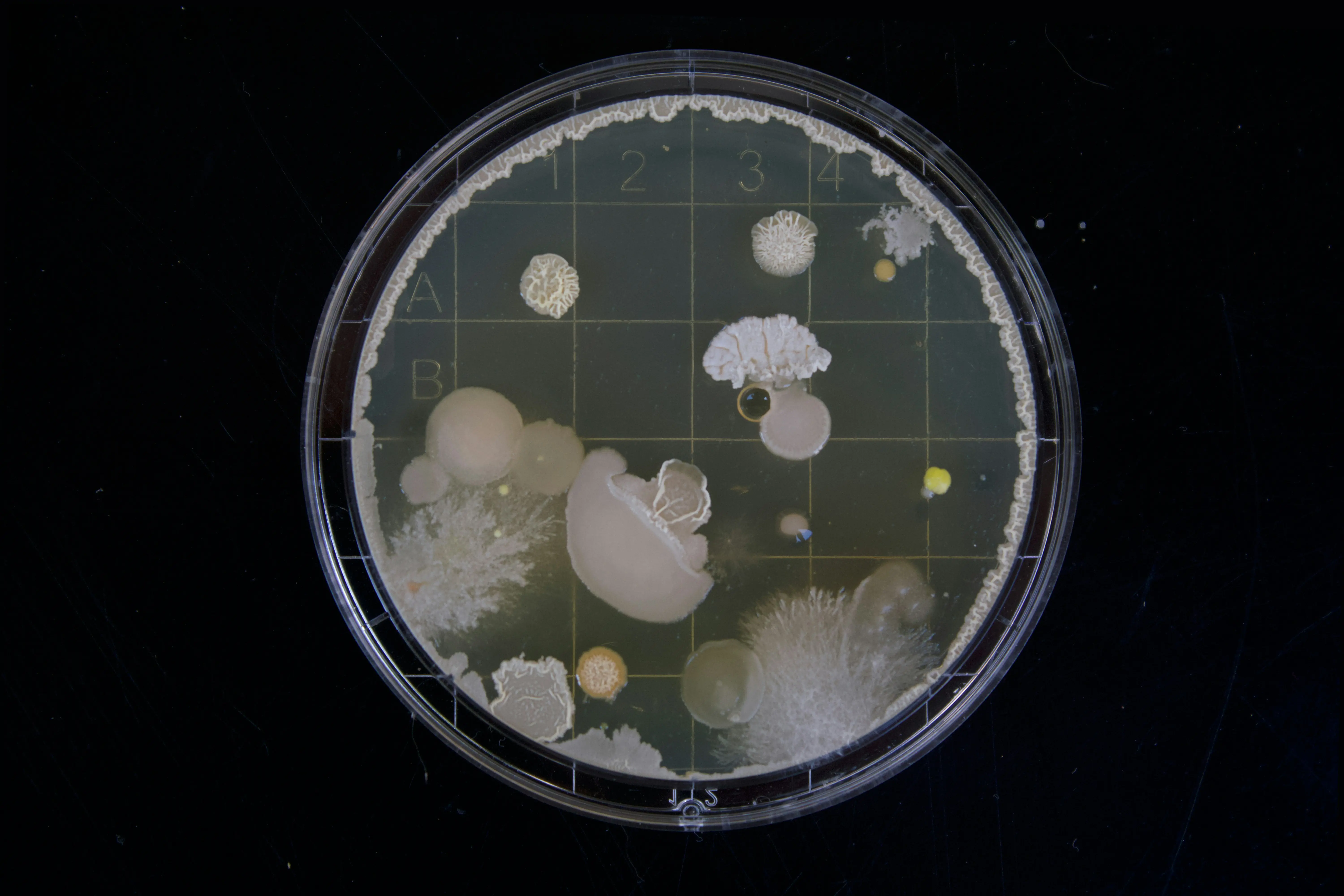 Deadly fungal infection surging through US: Symptoms, prevention and, affected states