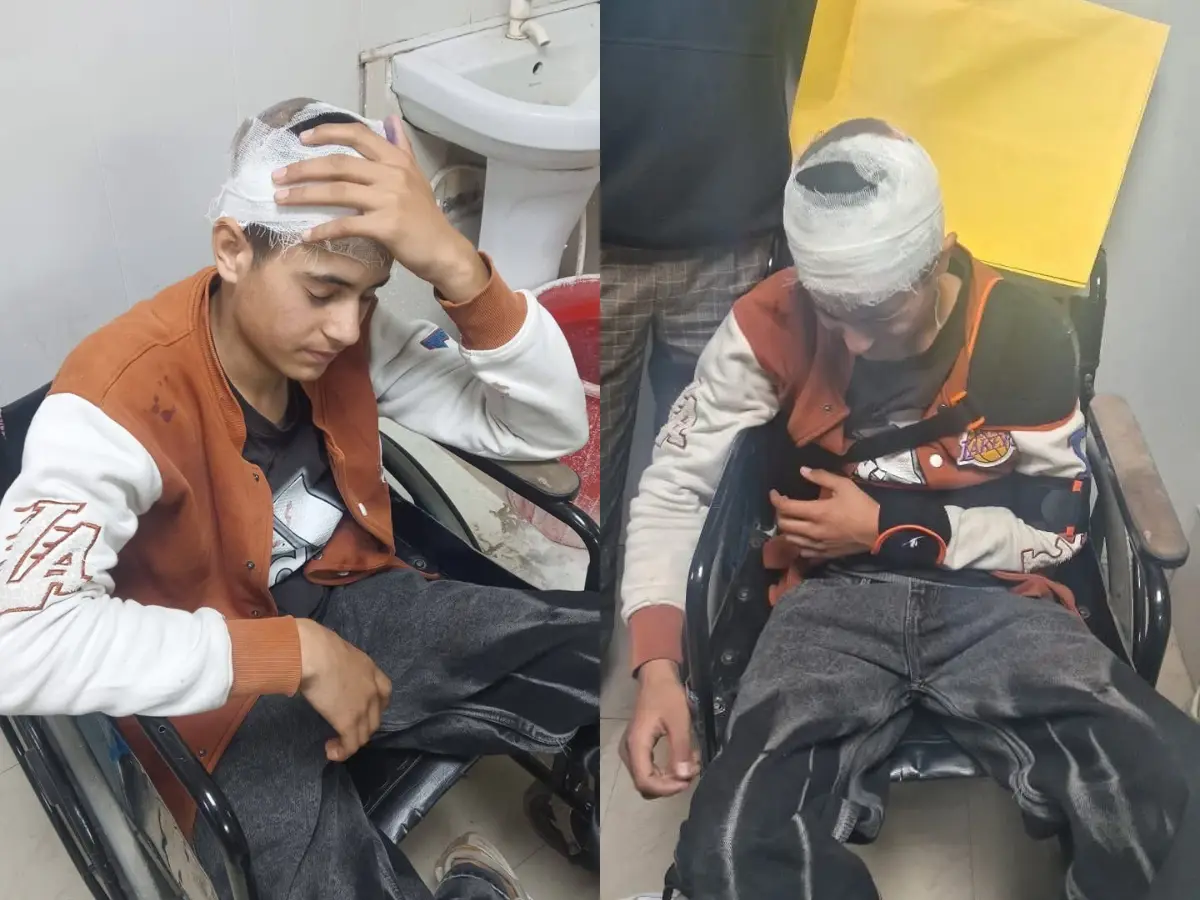 Outrage after 18-year-old Kashmiri shawl seller brutally assaulted by mob in Uttarakhand Outrage after 18-year-old Kashmiri shawl seller brutally assaulted by mob in Uttarakhand