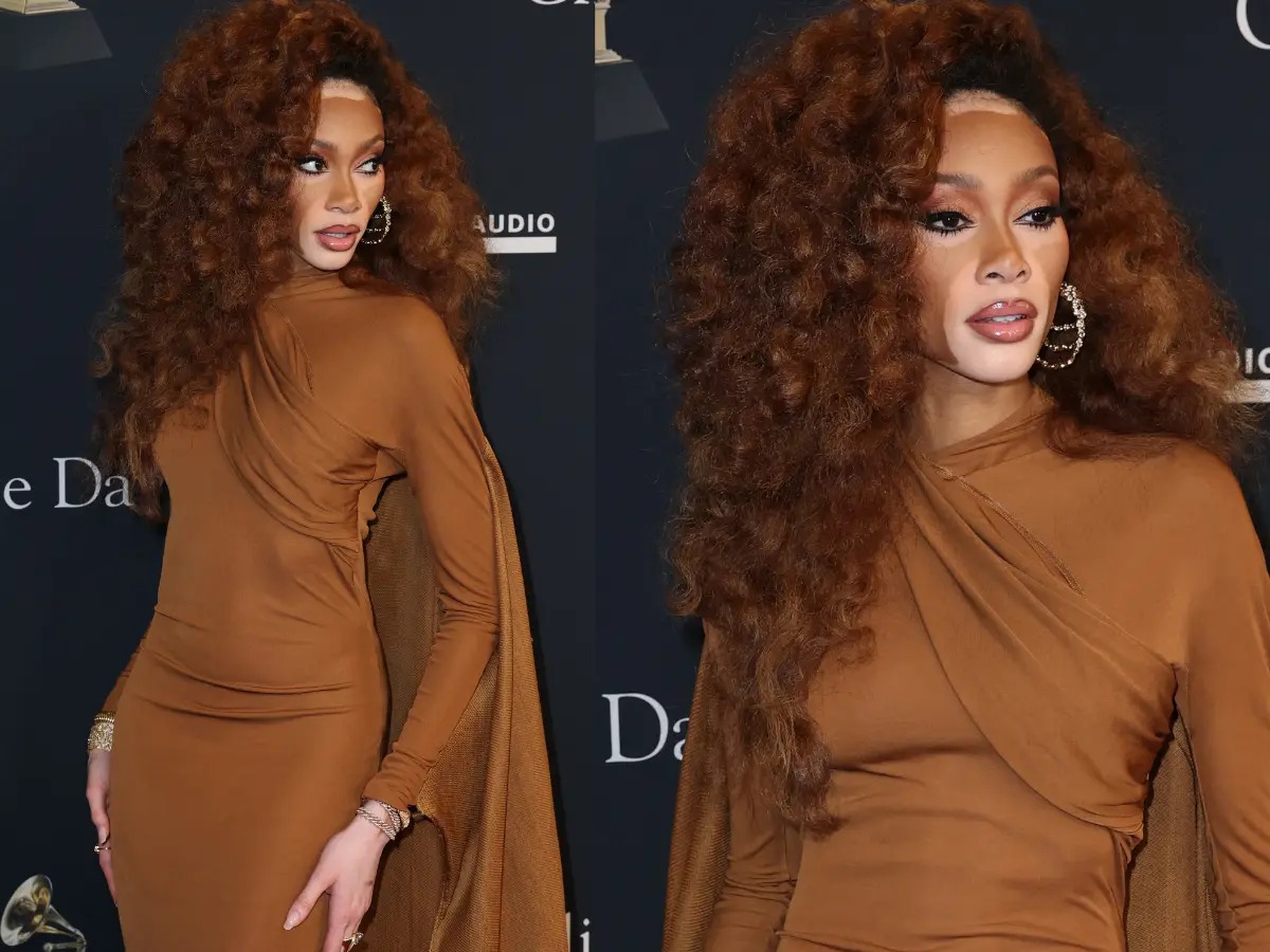 Winnie Harlow