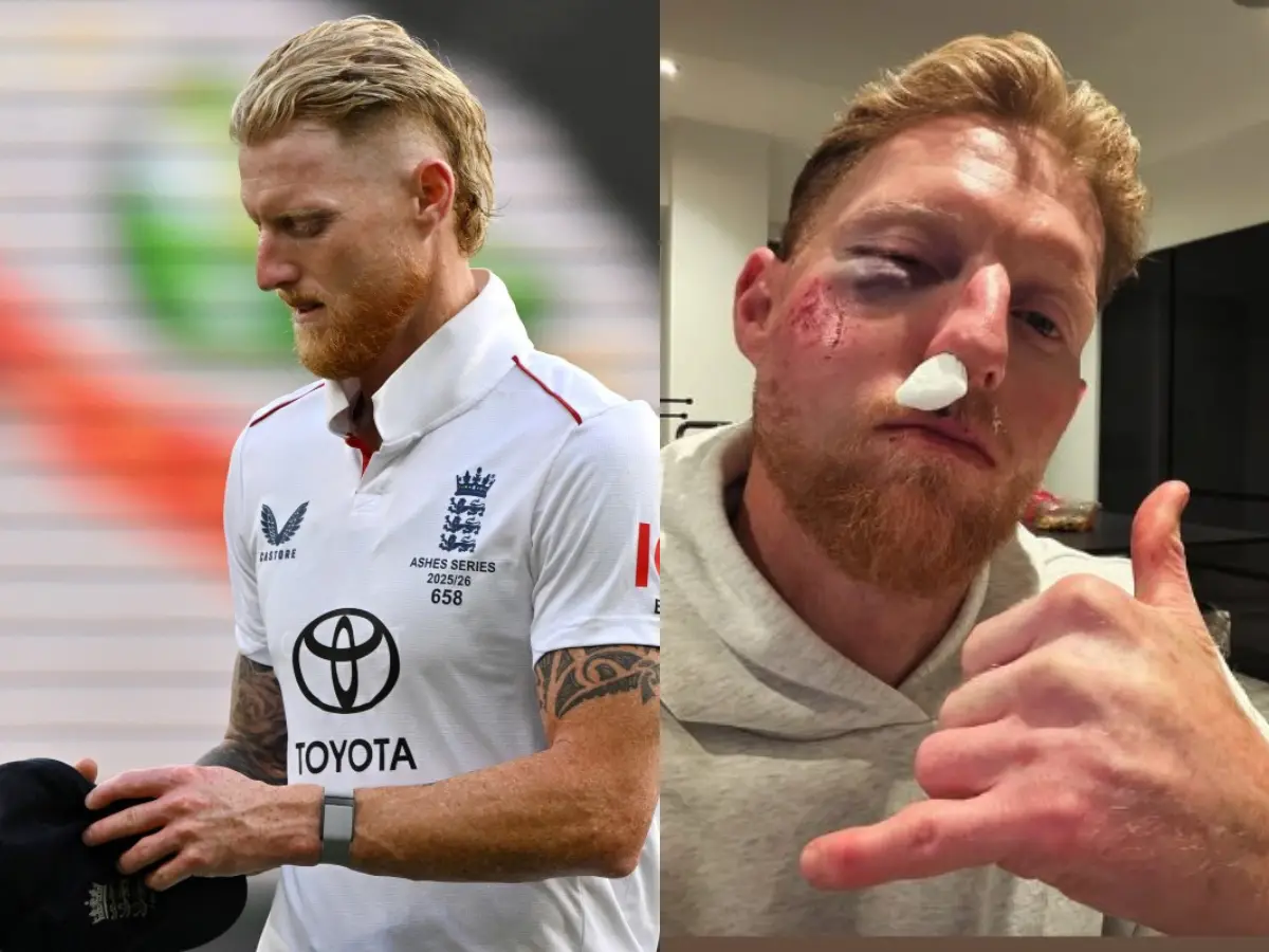 Ben Stokes brutally injured in training, reveals severely bruised right eye, bleeding nose Ben Stokes brutally injured in training, reveals severely bruised right eye, bleeding nose