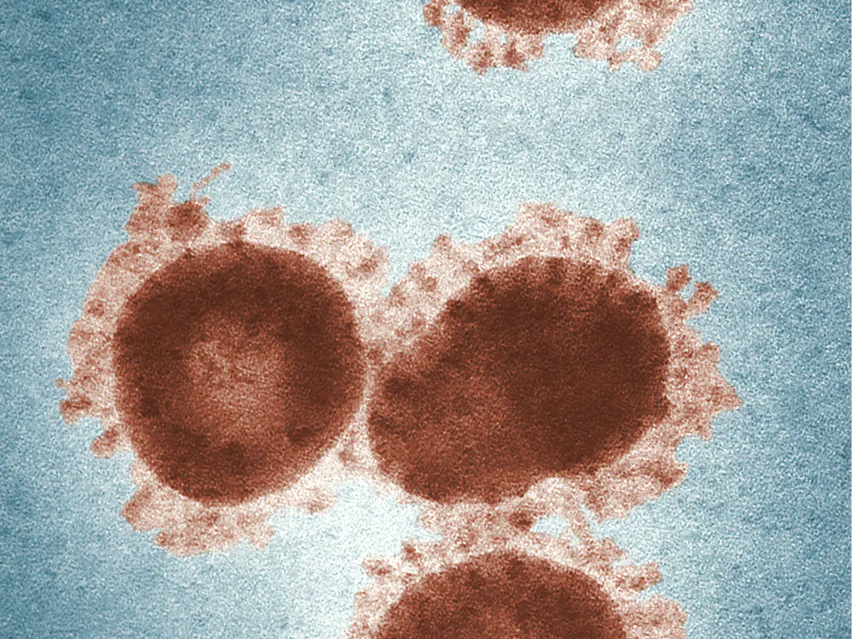 Burundi mysterious disease under watch