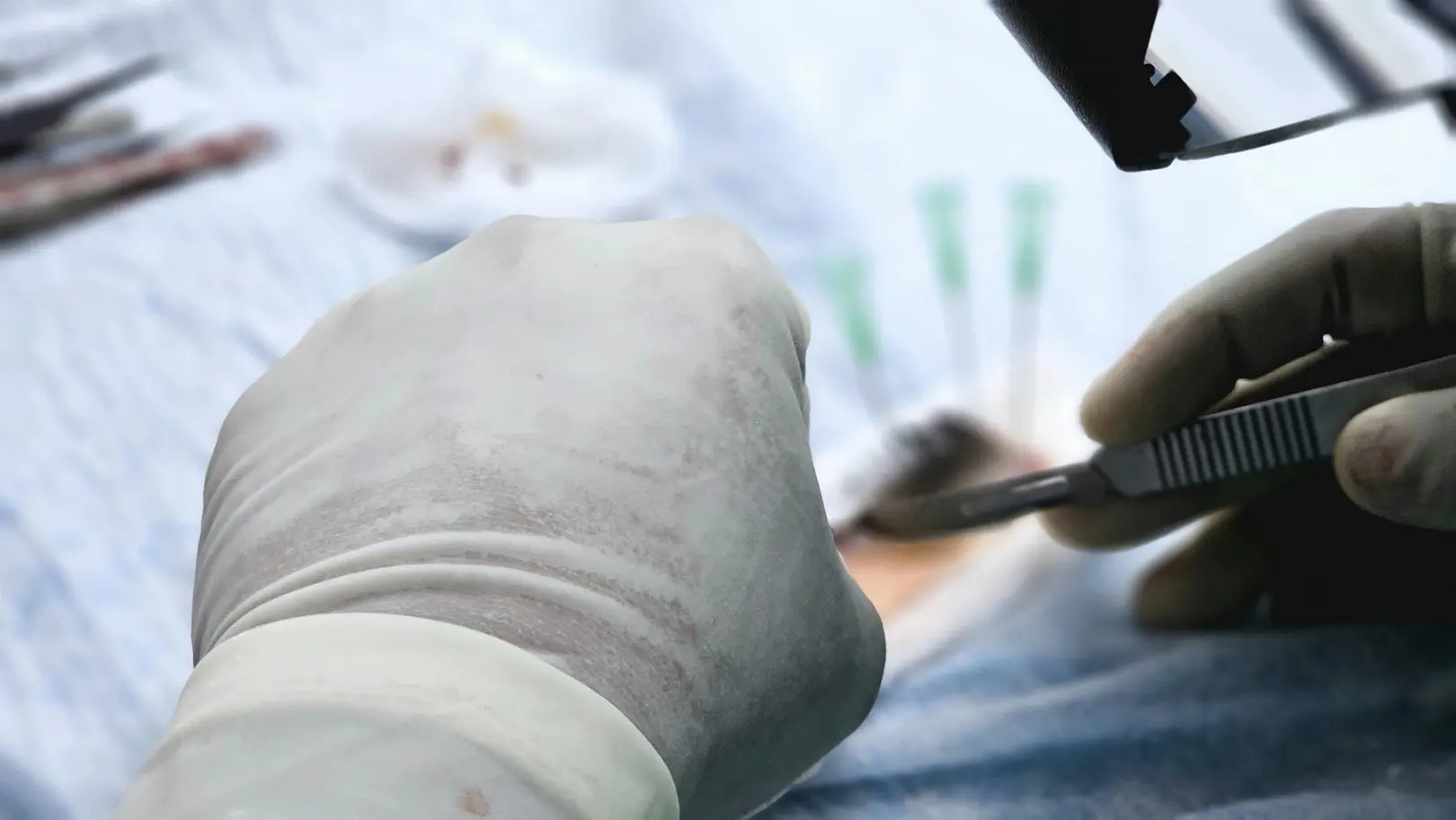 Pakistani Lashkar terrorist infiltrates to set up sleeper cells, gets hair transplant done in Srinagar