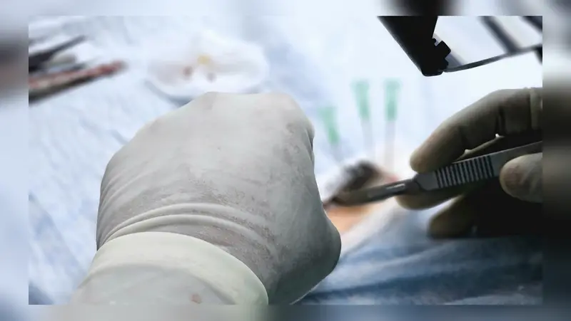 Pakistani Lashkar terrorist infiltrates to set up sleeper cells, gets hair transplant done in Srinagar Pakistani Lashkar terrorist infiltrates to set up sleeper cells, gets hair transplant done in Srinagar