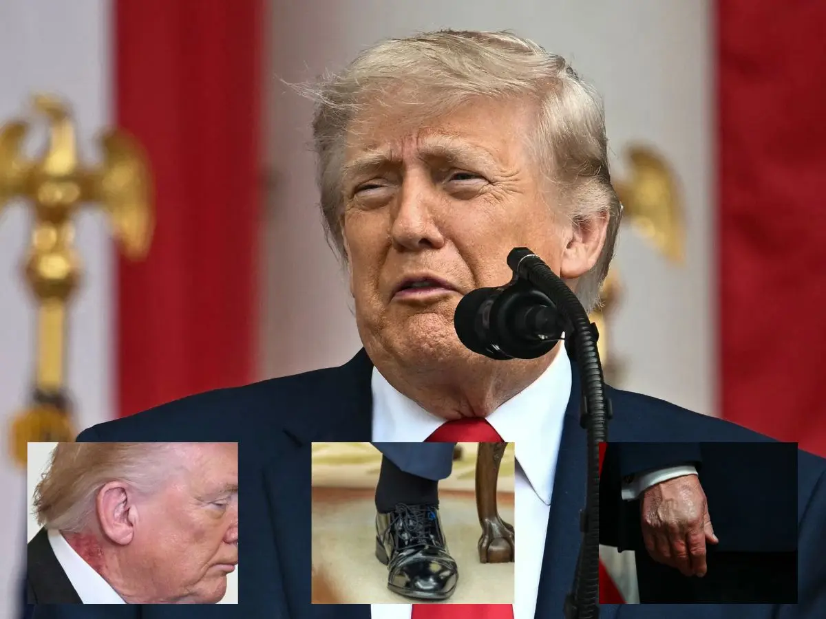 Trump takes annual physical just days before 80th birthday as health questions mount Trump takes annual physical just days before 80th birthday as health questions mount