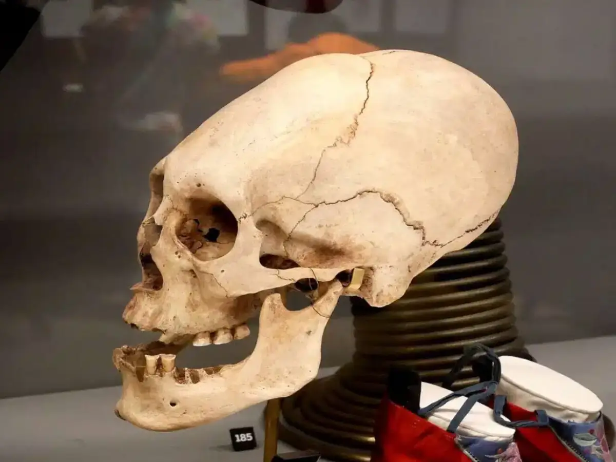 Peru conehead mummies: Another DNA analysis bites the dust as scientists fail to rule out 'extraterrestrial' origins Peru conehead mummies: Another DNA analysis bites the dust as scientists fail to rule out 'extraterrestrial' origins