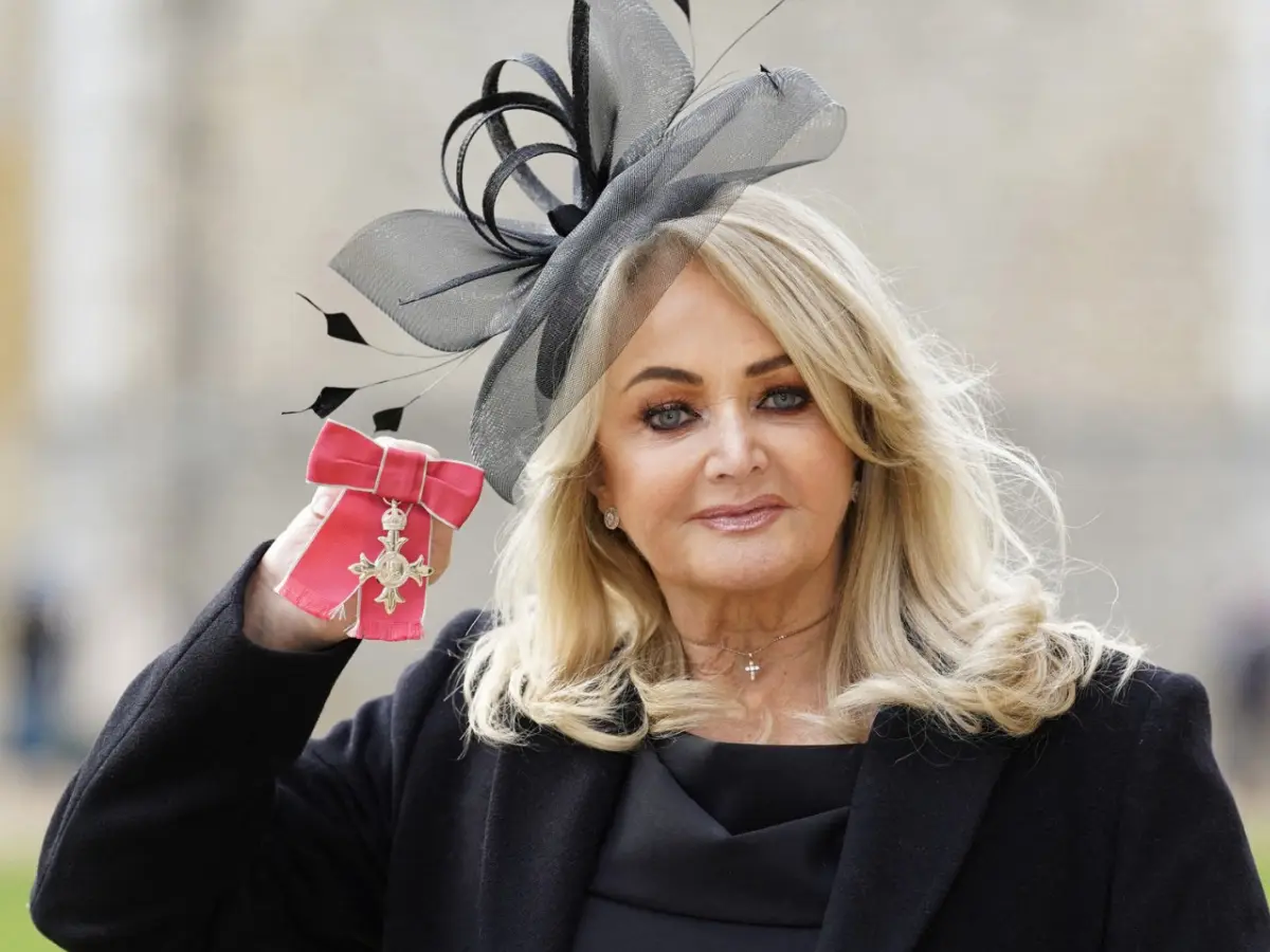 Bonnie Tyler, 74, the Welsh pop icon, dies following emergency intestinal surgery and coma Bonnie Tyler, 74, the Welsh pop icon, dies following emergency intestinal surgery and coma
