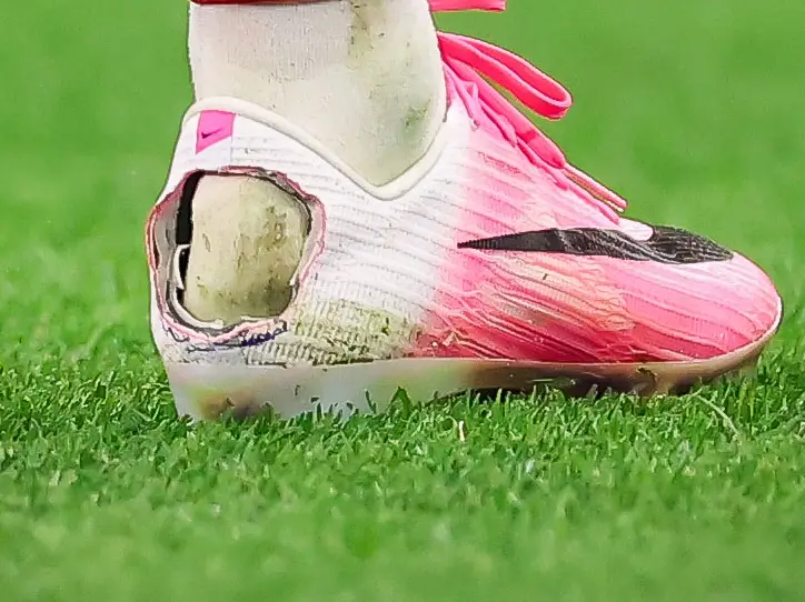 Why did Pedro Neto cut a hole in his football boot? The Haglund's deformity explained Why did Pedro Neto cut a hole in his football boot? The Haglund's deformity explained