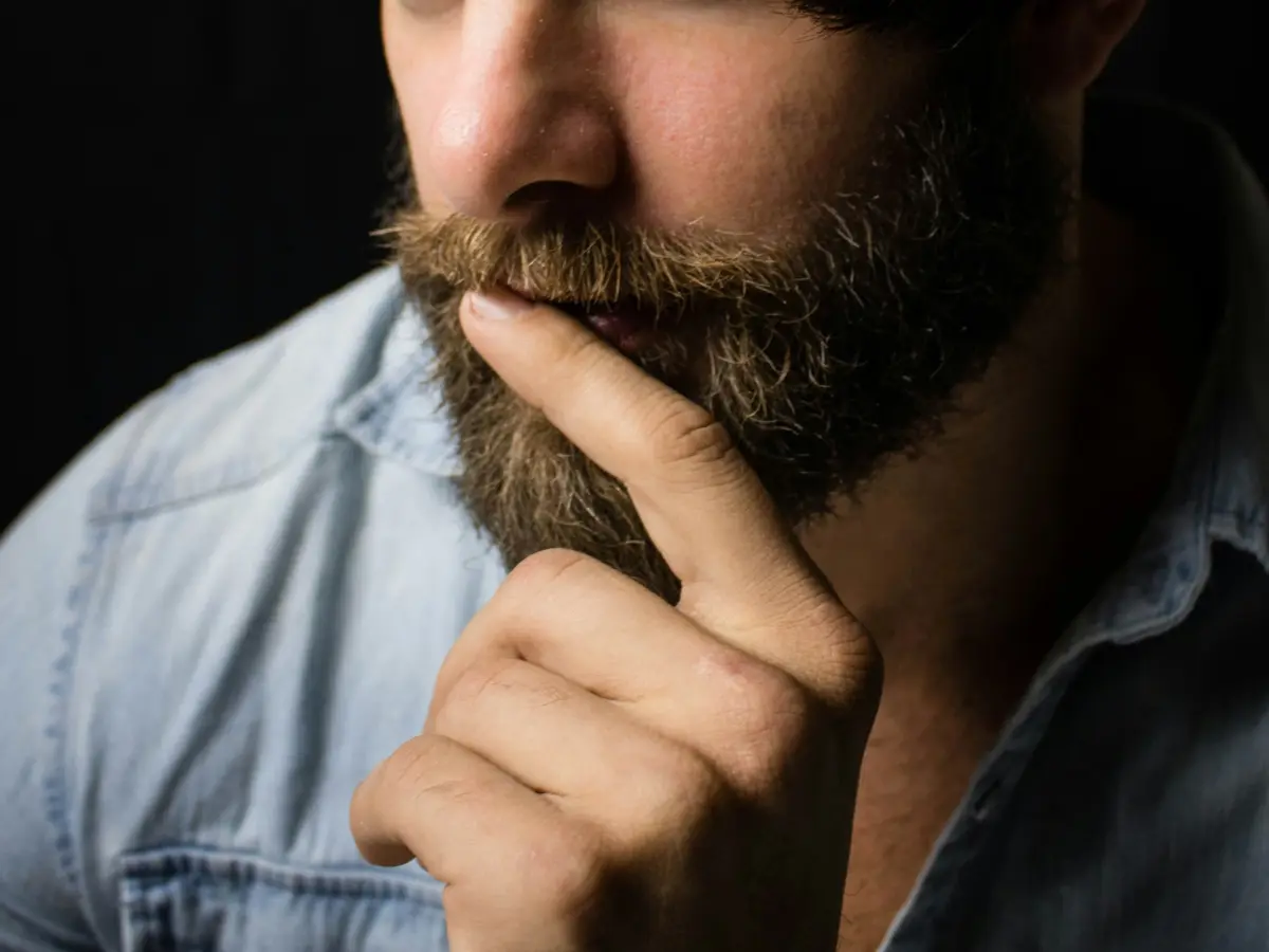 Man with babyish face spends Rs 10 lakh on beard transplant to be taken seriously at work Man with babyish face spends Rs 10 lakh on beard transplant to be taken seriously at work