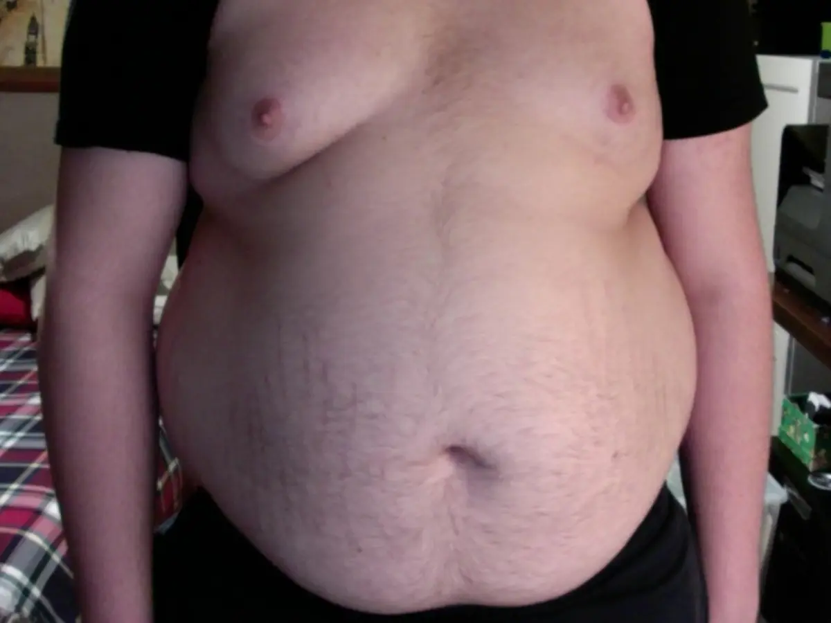 Why belly fat matters more than the number on the scale? GRAVITAS