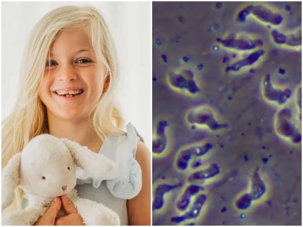 8-year-old Louisiana girl dies from rare brain-eating amoeba linked to lake swim