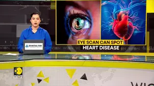 Study shows retinal changes may predict atrial fibrillation early 