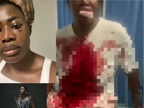 Ghanaian fashion icon Nana Akua Addo injury videos trigger domestic violence allegations Ghanaian fashion icon Nana Akua Addo injury videos trigger domestic violence allegations