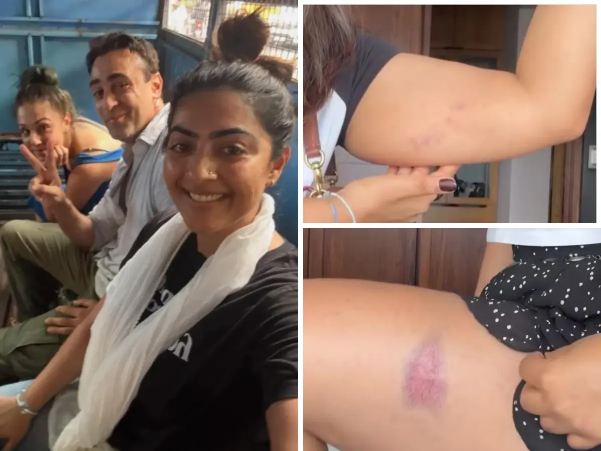 Aamir Khan's niece, actress Zayn Marie shares injury pictures after being detained with Imran Khan at Mumbai protest Aamir Khan's niece, actress Zayn Marie shares injury pictures after being detained with Imran Khan at Mumbai protest