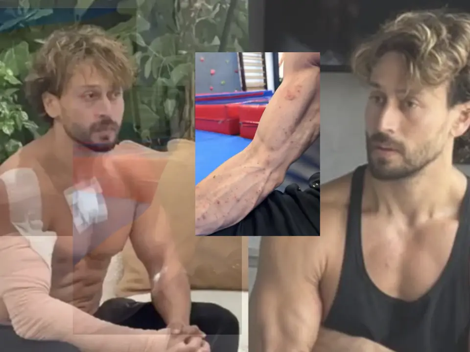 Red marks on Tiger Shroff's hand: New video shows injury from Juhu firing after bandage debate Red marks on Tiger Shroff's hand: New video shows injury from Juhu firing after bandage debate